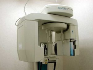 デジタルレントゲン